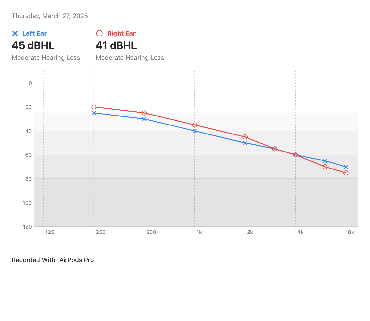 Audiograms: Moderate hearing loss