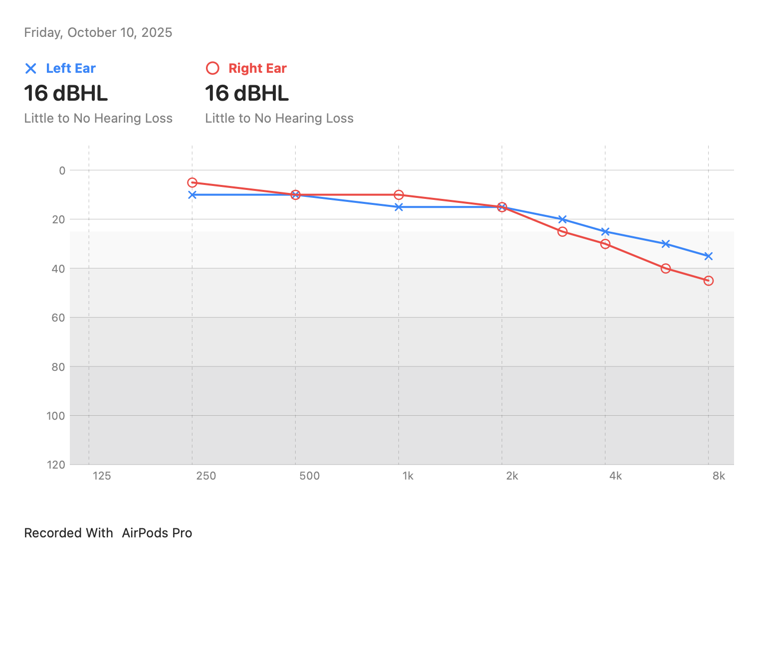 Audiograms: Little to no hearing loss