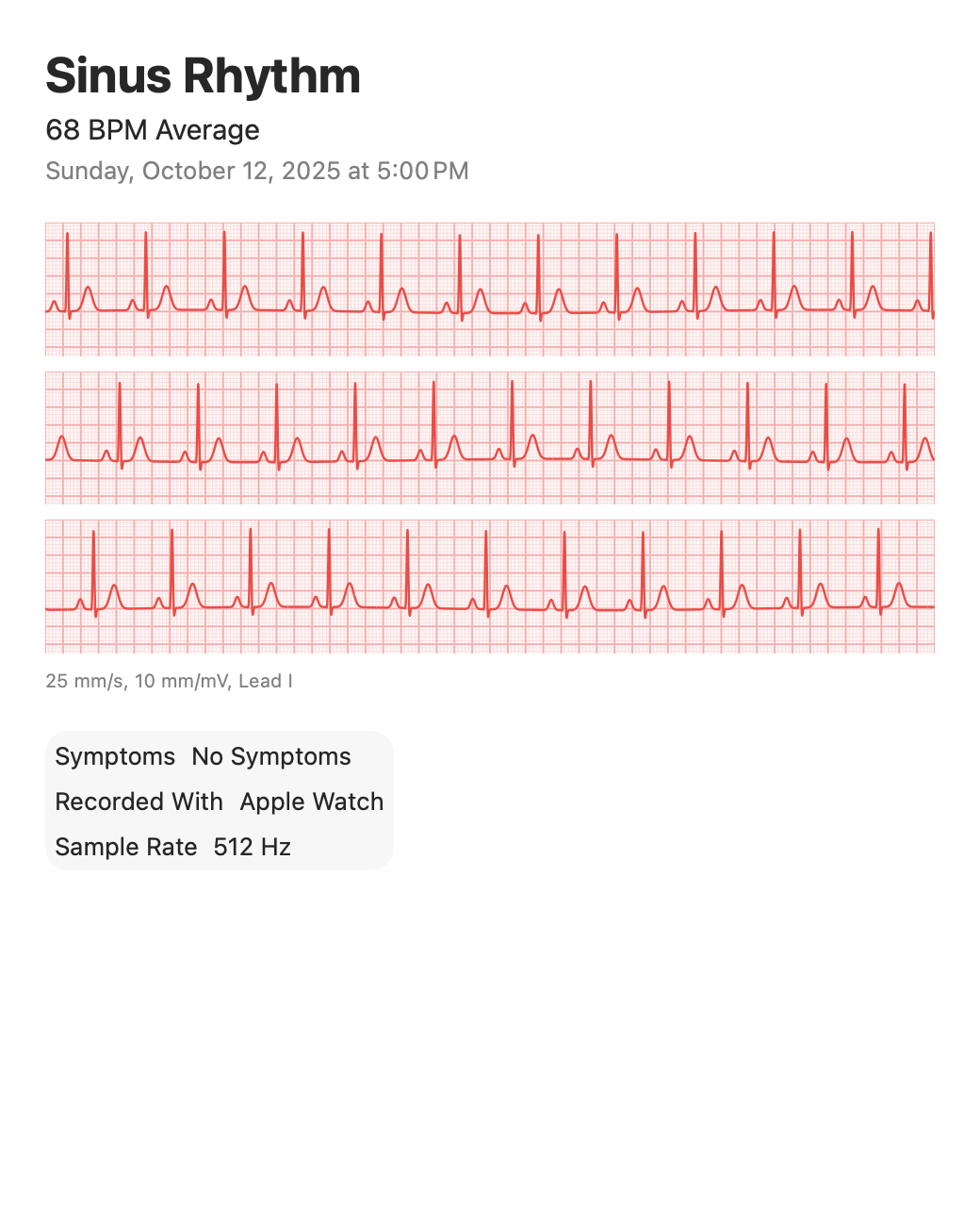 Electrocardiograms: Tall waves, narrow window