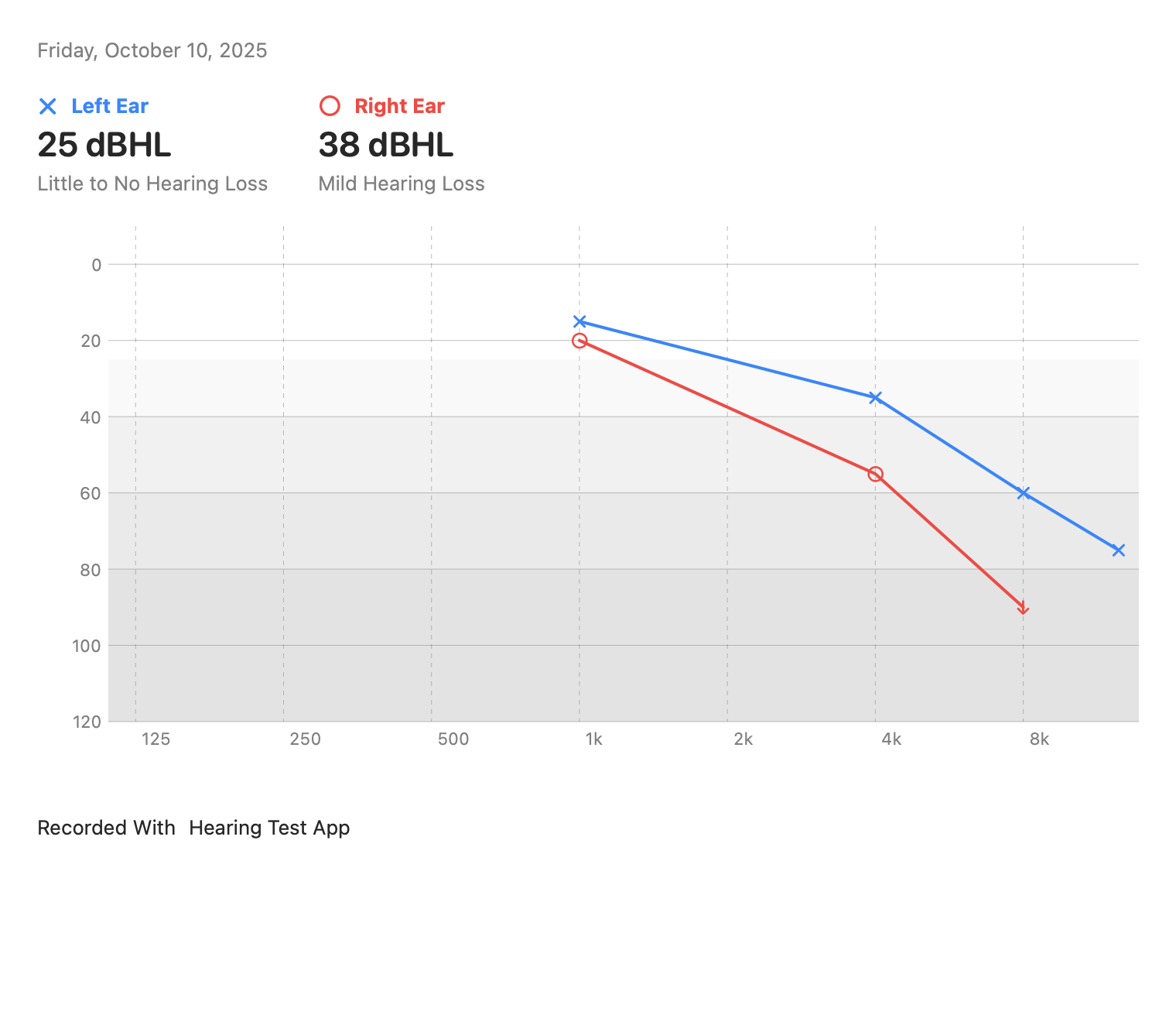 Audiograms: No response at 8 kHz, extended frequencies