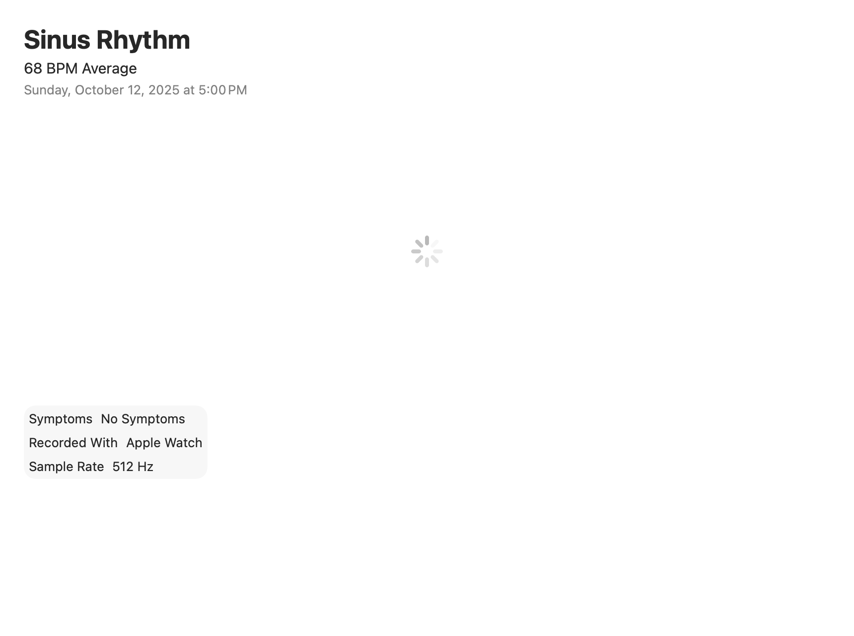 Electrocardiograms: Recording loading